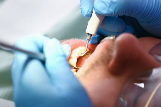 Best Urgent Tooth Repair  in Poncha Springs, CO